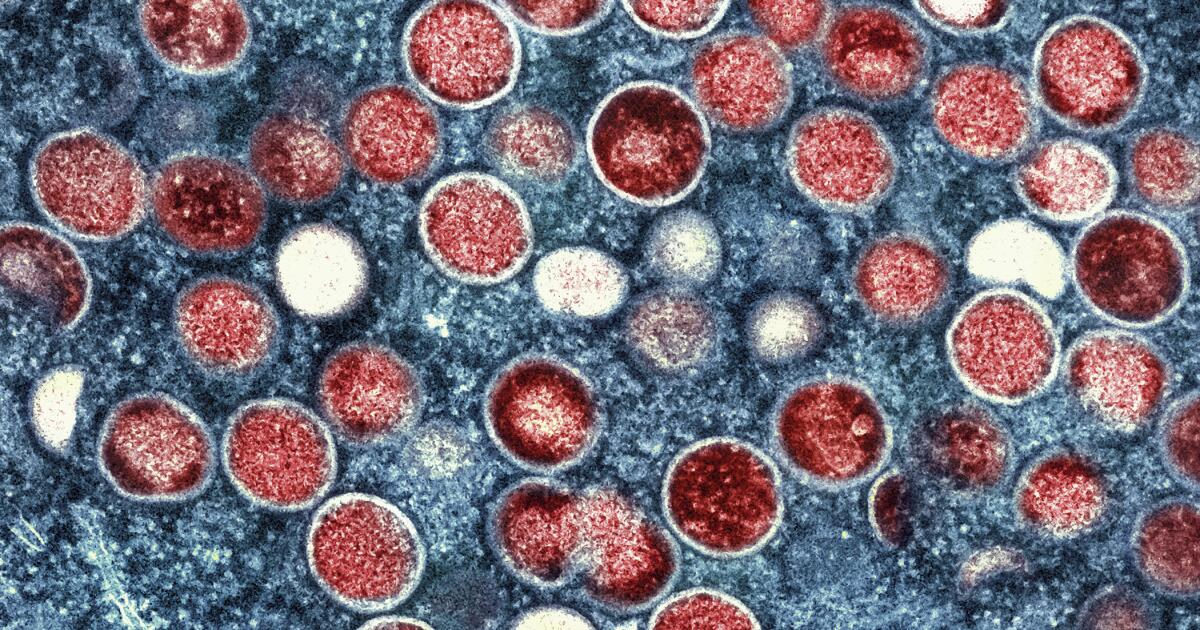 Se confirman 2 casos de cepa mpox posiblemente más grave en el condado de Los Ángeles